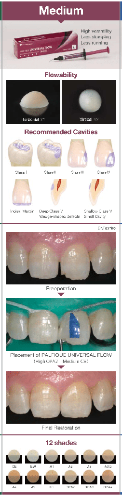 Resina Composite fluida Palfique Universal Flow M Tokuyama (2)