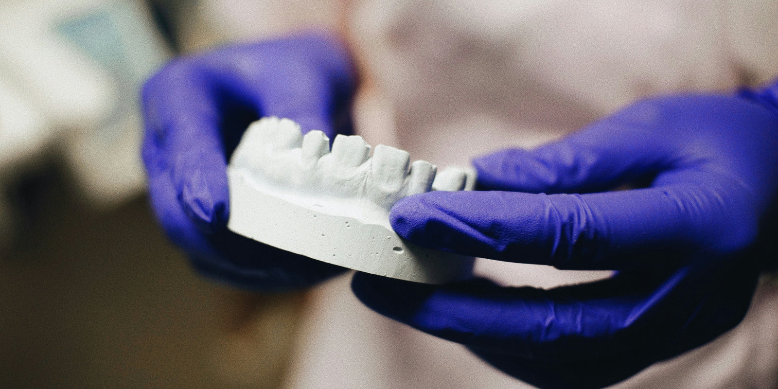 ¿Qué adhesivo dental elegir?