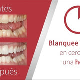 Blanqueamiento Opalescence Boost 40% (1 Jeringa + 1 Opaldam)