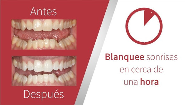 Blanqueamiento Opalescence Boost 40% (1 Jeringa + 1 Opaldam)